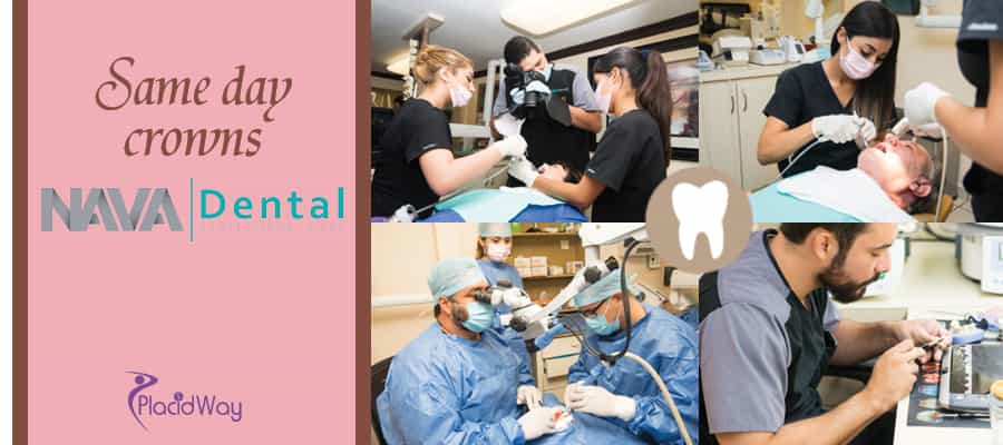 Nava Dental Clinic -Same Day Dental Crowns